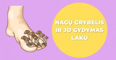 Nagų grybelis ir jo gydymas laku: kokie pliusai?